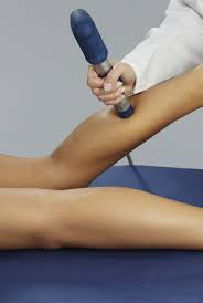 Shockwave Therapy Gilbert AZ